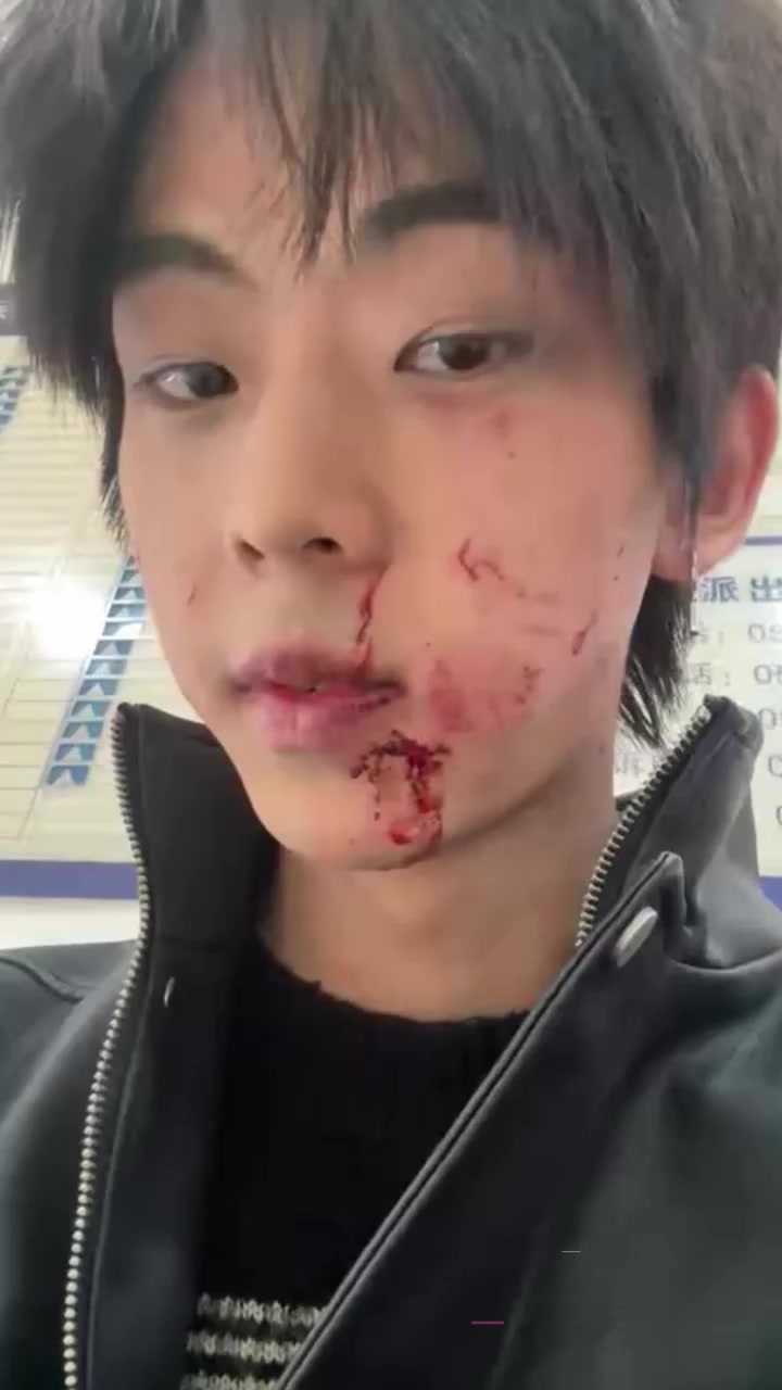 福建福州饥渴小富婆 包养男模被嫌弃逼臭 一怒之下将其打至毁容 两人撕逼曝光大量聊天记录与性爱视频！1