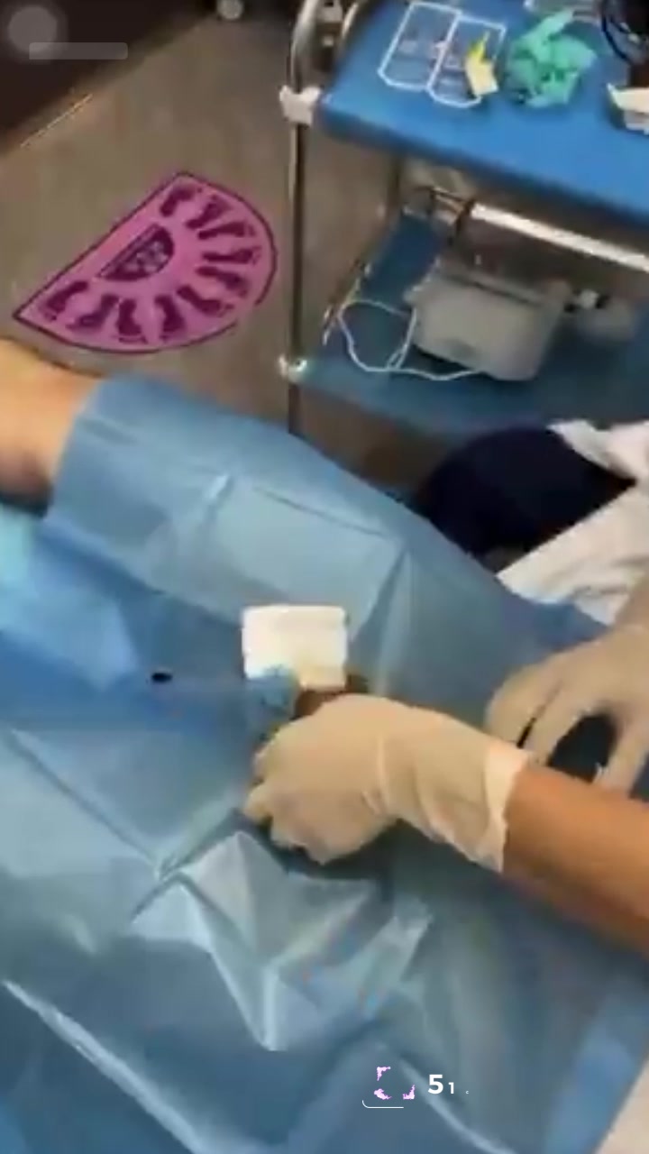 顶流男星 王鹤棣 上海做阴茎增粗变阳痿 手术视频被曝 网友靠腿毛对比破案2